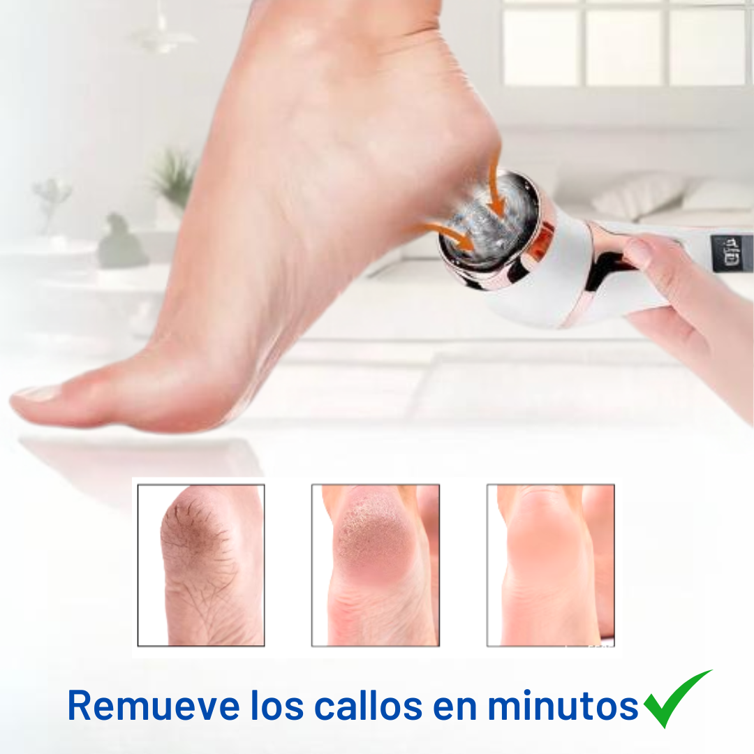 Removedor de callos FootEase™